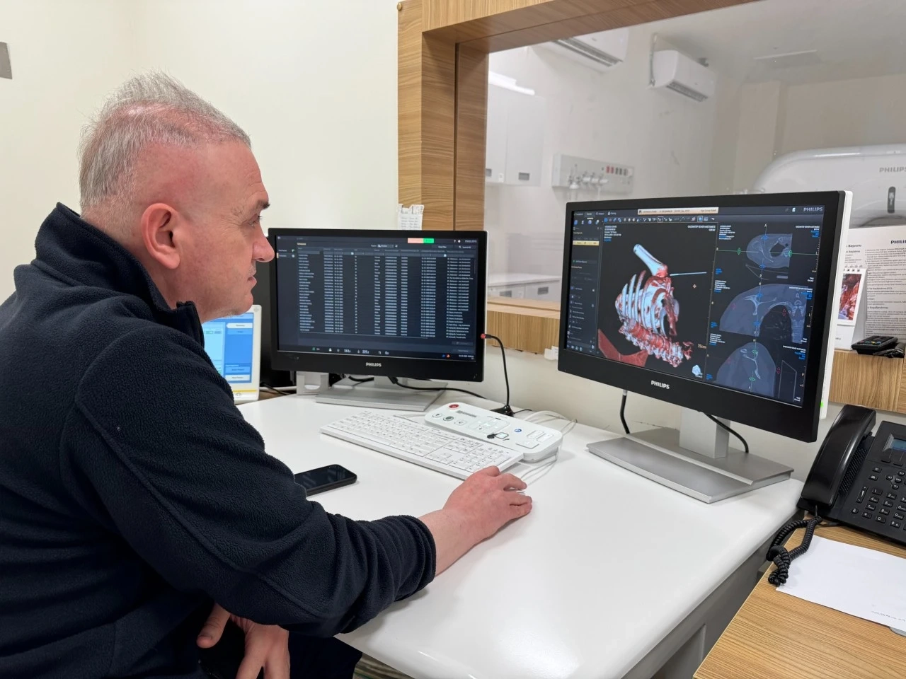 Gaziantep Şehir Hastanesi’nde Artrografi Uygulaması Başarıyla Gerçekleştiriliyor