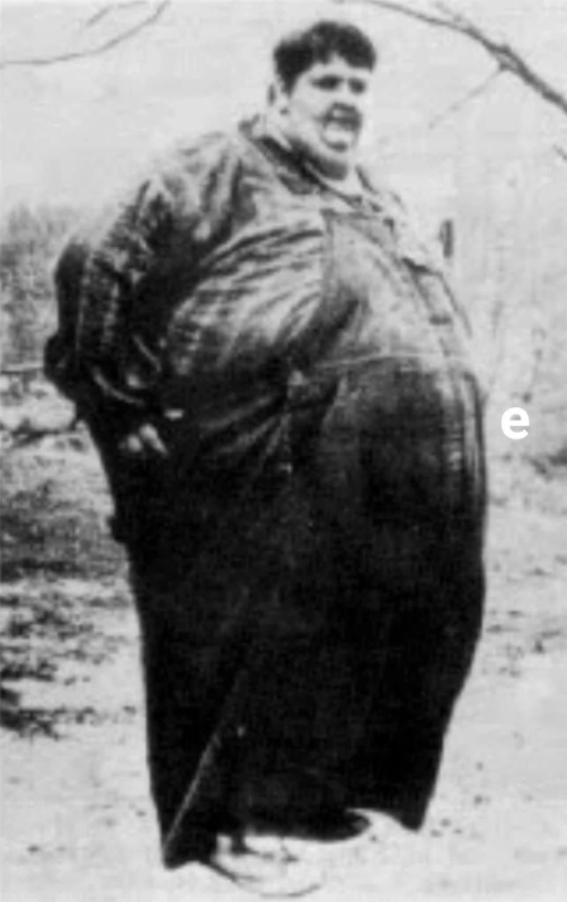 Dünyanın En Ağır İnsanı Jon Brower Minnoch: 635 Kilo ile Tarihe Geçti